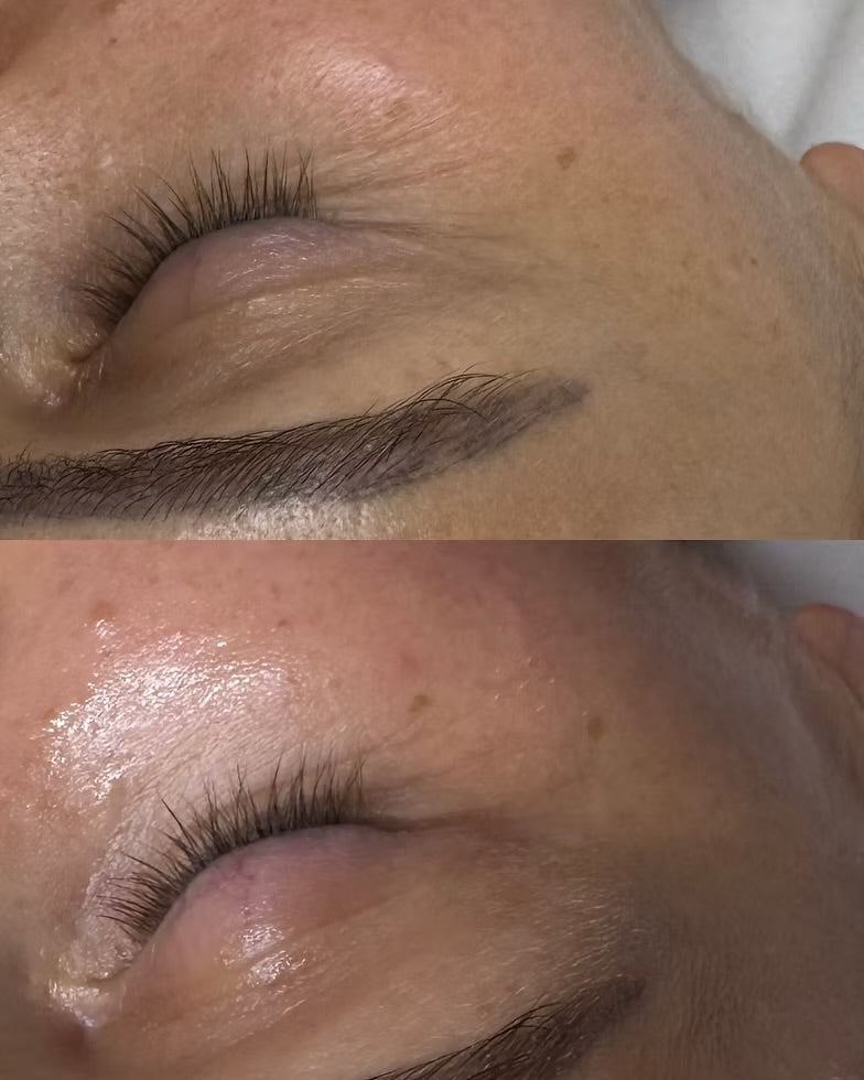 Kit Youth Eye Complex 15 ml og C Eye serum advance+15 ml